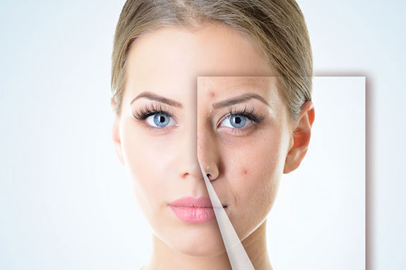 Enhance Your Complexion Nearby: Microneedling Solutions